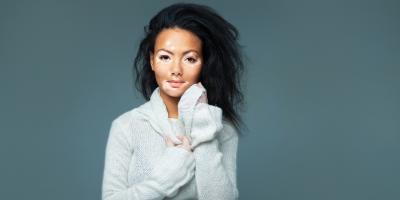 كريم أوبزيلورا Opzelura أول علاج معتمد لمرض البهاق .. ماذا يجب أن تعرف عنه؟