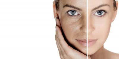 ما هي تصبغات الجلد؟ اسبابها وعلاجها