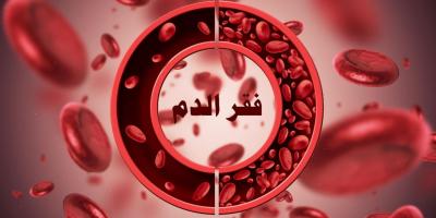 مرض فقر الدم: الأنواع، الأعراض، العلاج