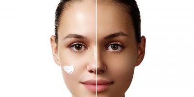 احذري.. كريمات تفتيح البشرةليست آمنة كما تعتقدين وتعرضك لمخاطر صحية