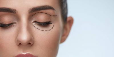 تناولي هذه الأطعمة للتخلص من الهالات السوداء