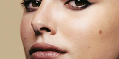 5 علاجات طبيعية فعالة لإزالة شامة الوجه.. تعرفي عليها 
