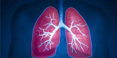 ما هي أعراض سرطان الرئة المبكرة؟ إليك التفاصيل كاملة