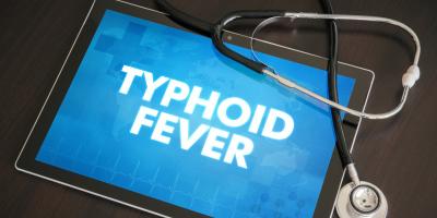 5 نصائح غذائية وصحية لعلاج حمى التيفود