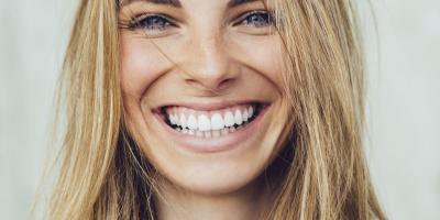 5 أطعمة تساعد على تبييض الأسنان..تعرفي عليها!