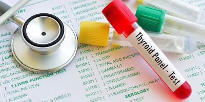 دراسة تكشف علاقة بين وظائف الغدة الدرقية ومشاكل القلب