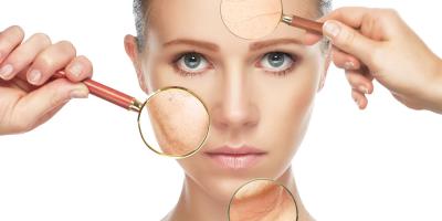 6 علاجات تجميلية مجربة لمكافحة التجاعيد!