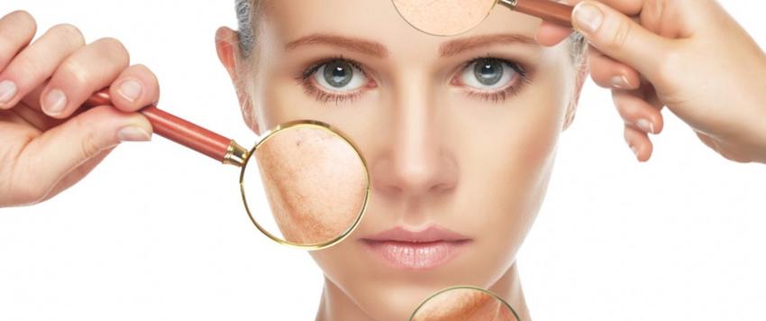 البشرة الجافة