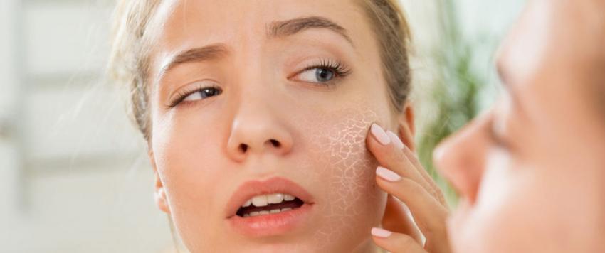 جفاف البشرة