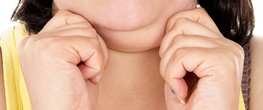 الذقن المزدوج