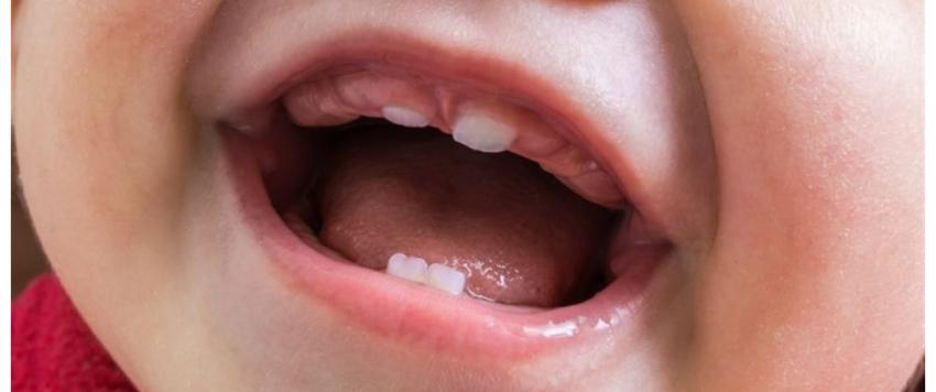 حساسية الفم لدى الأطفال