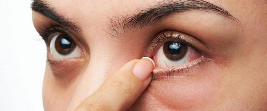 جفاف العين في الشتاء..أسبابه وعلاجه!