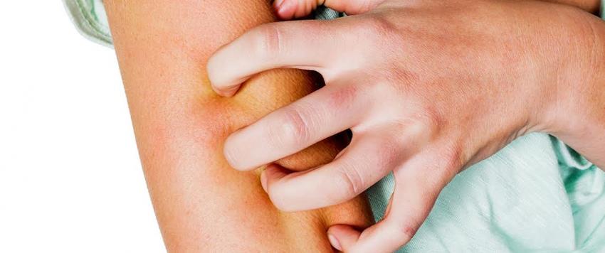 9 وصفات طبيعية للتخلص من الناموس في المنزل