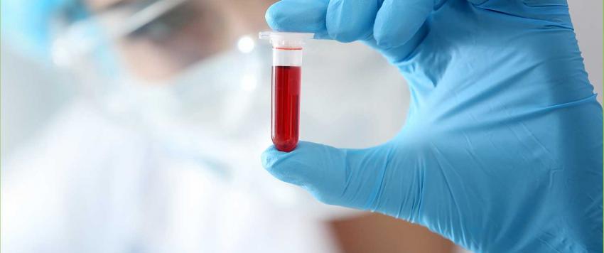 سرطان الدَّم اللمفاوي المُزمِن