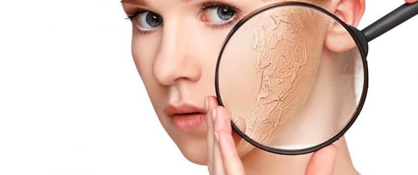 البشرة الجافة