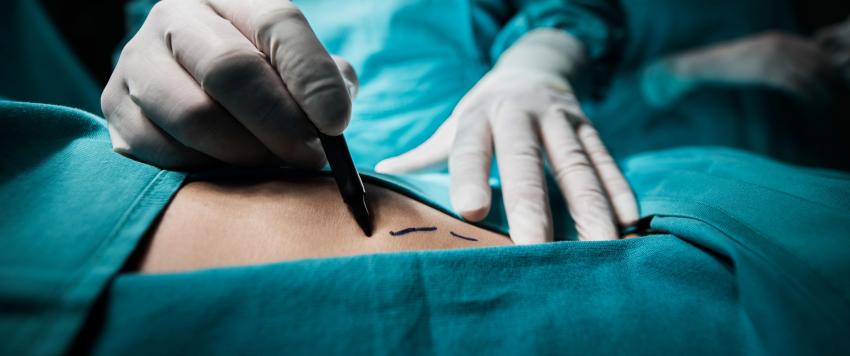 عمليات تجميلية رخيصة تشوه السيدات في المكسيك