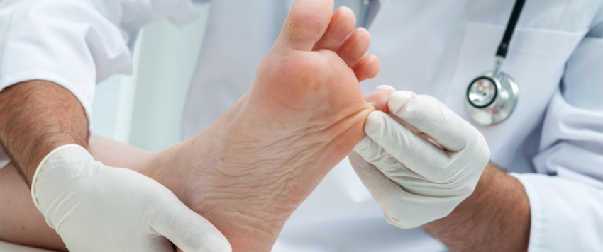 تقرحات القدم