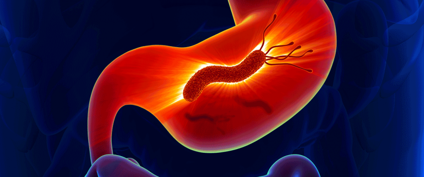 جرثومة المعدة