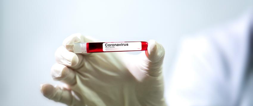 أطعمة تساعد على التعافي من كورونا