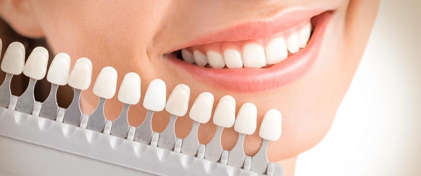 أسنان البالغين 