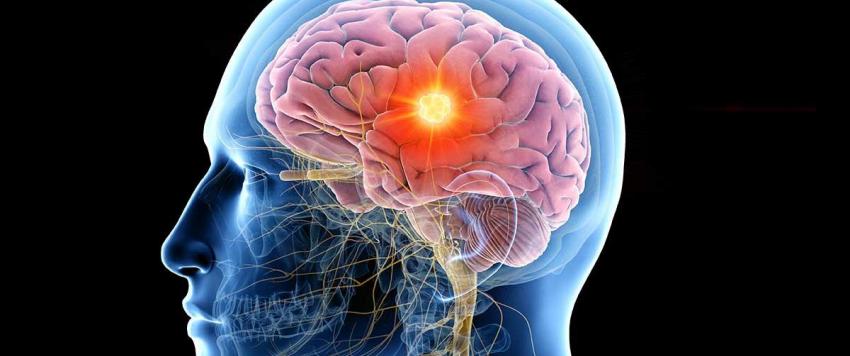 نوبات الصرع 