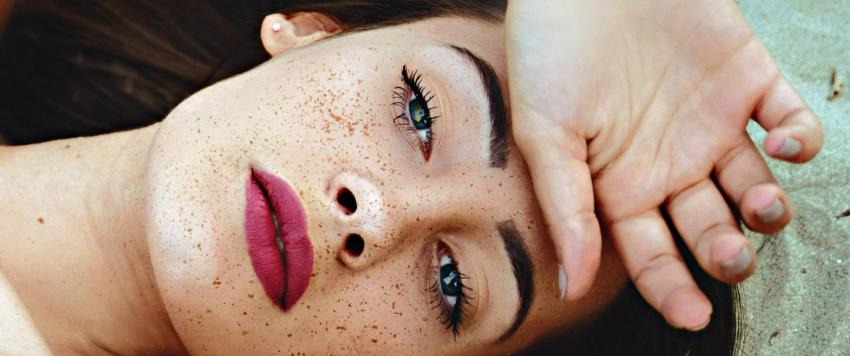 تعرفي على أسباب ظهور النمش الأبيض على ذراعيك وطرق التخلص منه