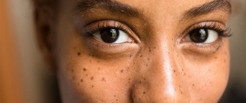 مشاكل شائعة في البشرة تظهر أثناء الحمل 